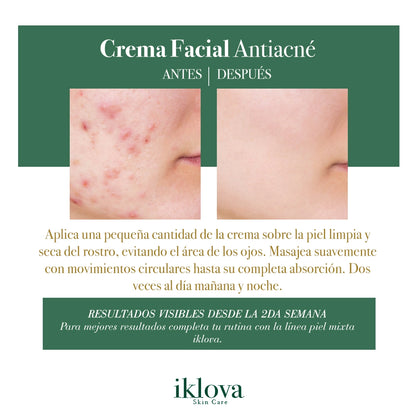 Crema Facial Piel Mixta (Té Verde + Árbol de Té), Libre de Aceites