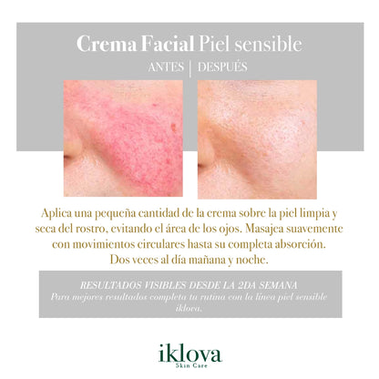Crema Facial Ácido Hialurónico + Niacinamida (B3) + Extracto de Aloe