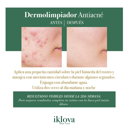Dermolimpiador Piel Mixta