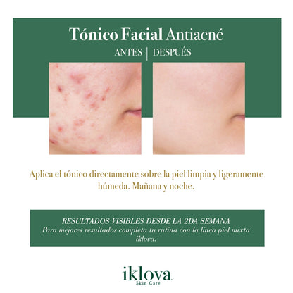 Tónico Facial Piel Mixta