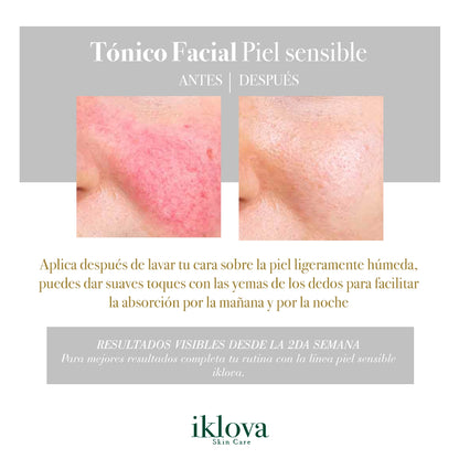 Tónico Facial Niacinamida (B3) + Azuleno