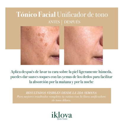 Sérum de Ácido Hialurónico + Vitamina C + Factor Aclarante